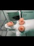 Thumb 6